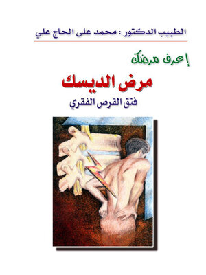 cover image of مرض الديسك - فتق القرص الفقري